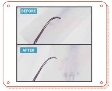 やました歯科医院_シャープニング